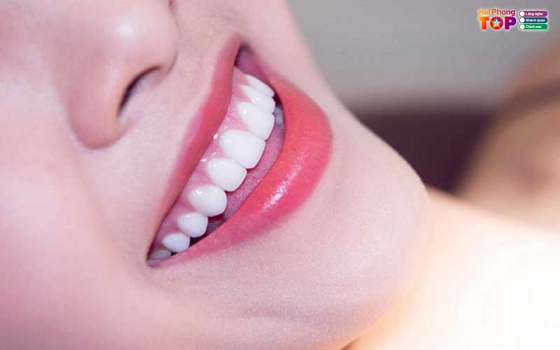 Tieu-chi-lua-chon-dia-chi-boc-rang-su-hai-phong-uy-tin-haiphongtoplist