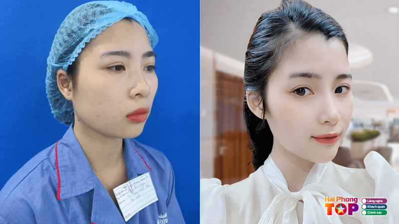 Top-5-dia-chi-don-cam-hai-phong-an-toan-chi-phi-hop-ly